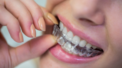 5 Retainer and Clear Aligner Matters to Pay Attention To